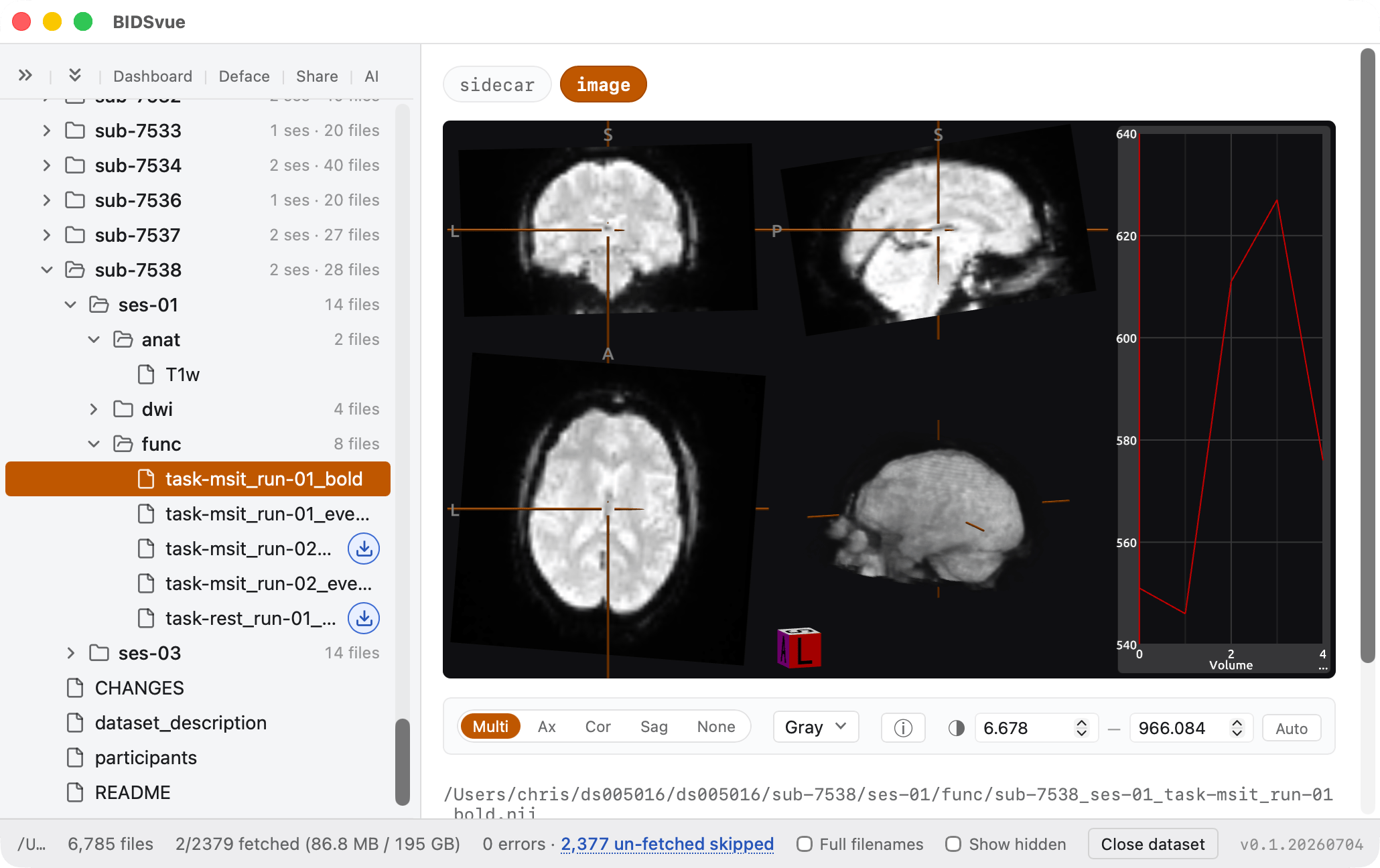 An fMRI BOLD timeseries.