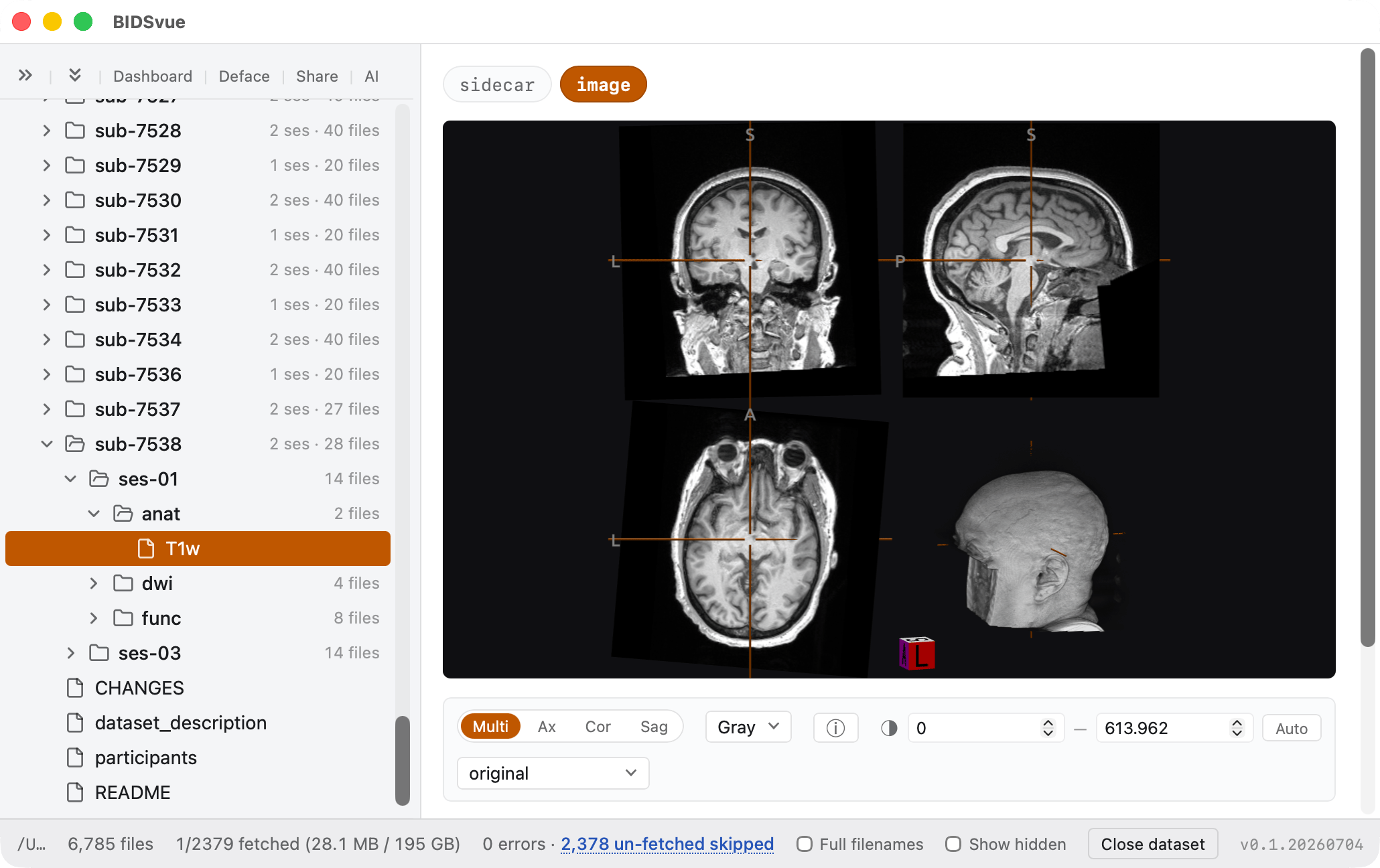 A de-faced T1w scan.