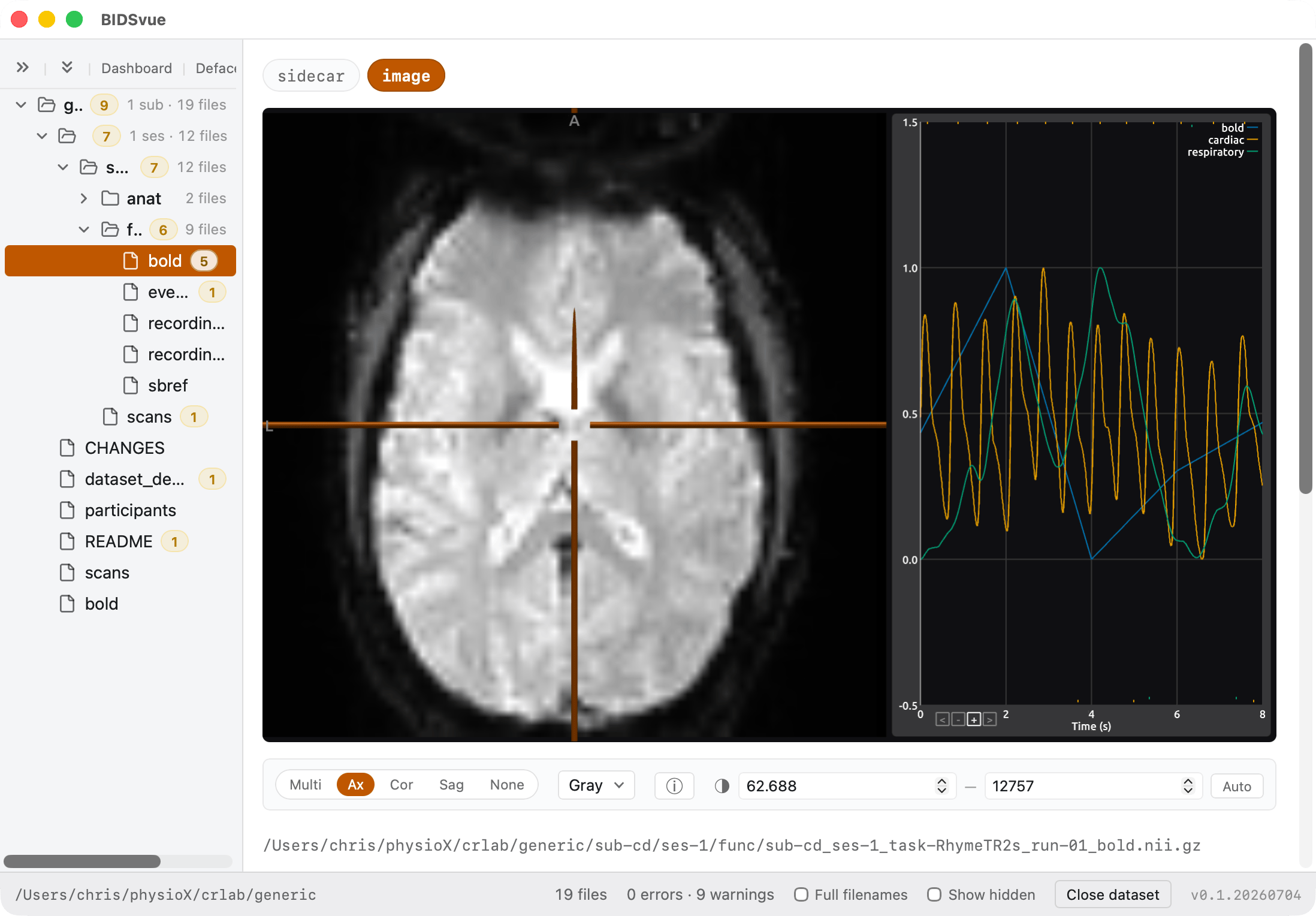 Viewing physiological data alongside an MRI timeseries.