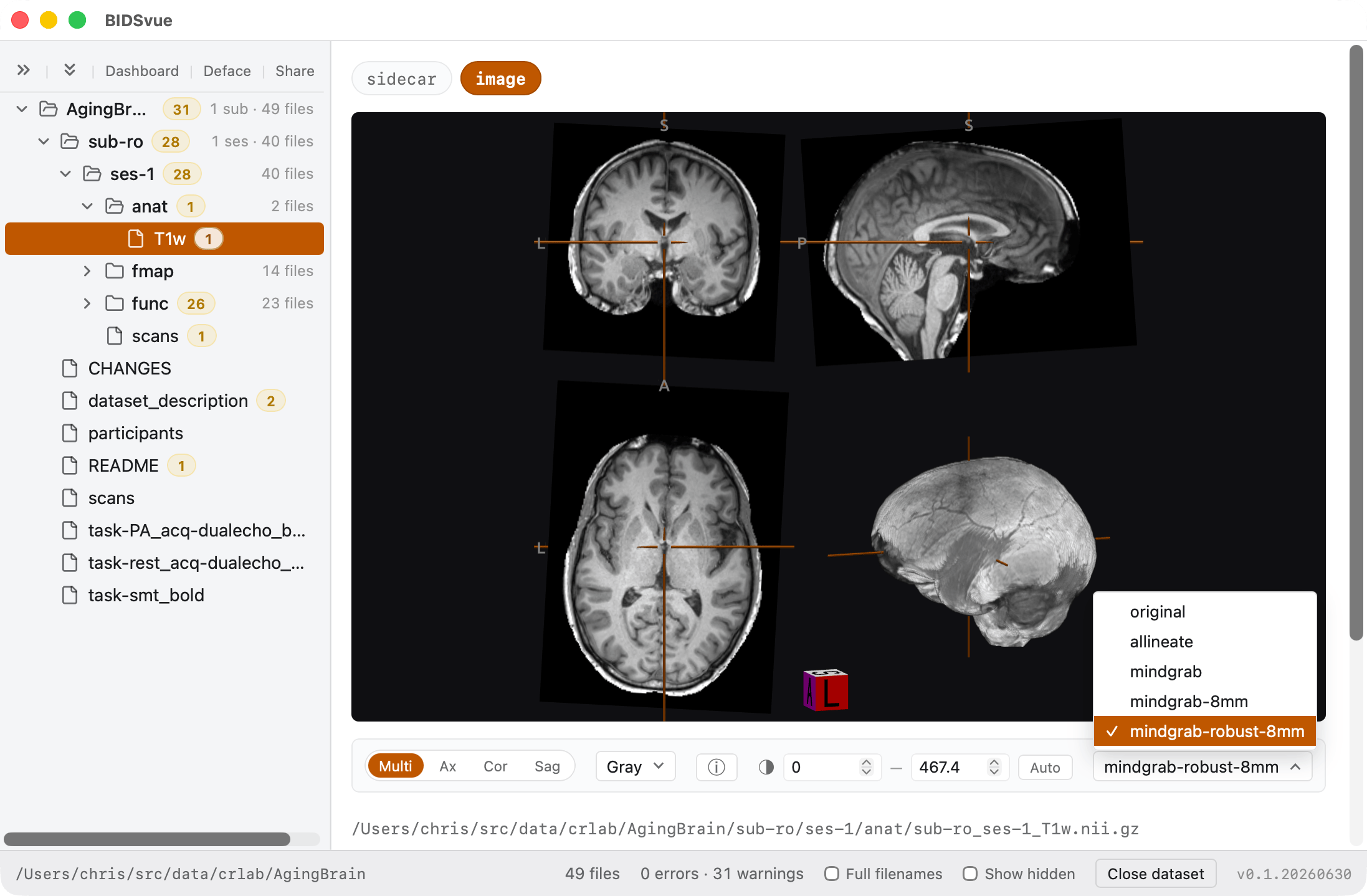 Viewing the T1w image with the mindgrab defacing method selected.