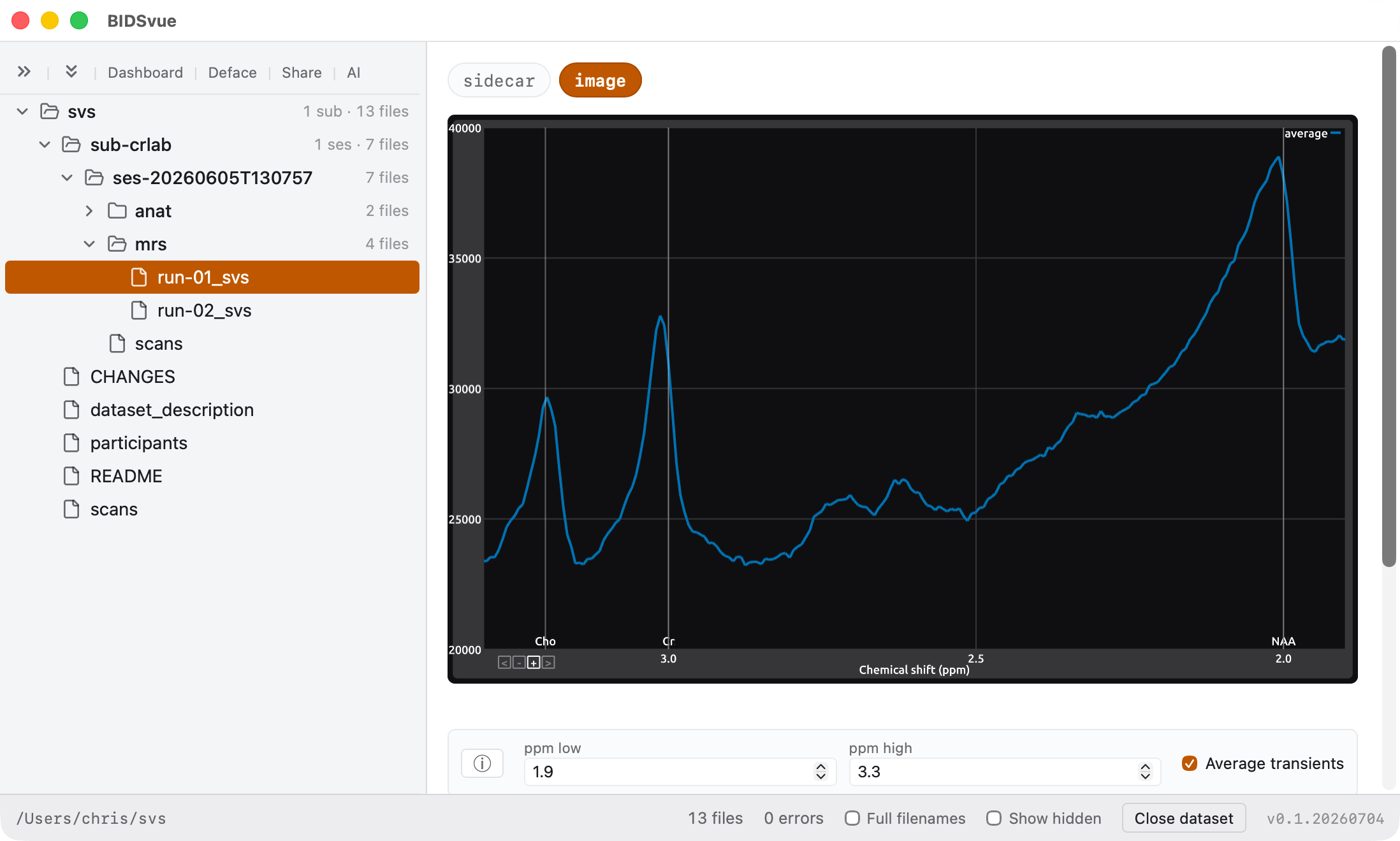 Viewing MRS data.